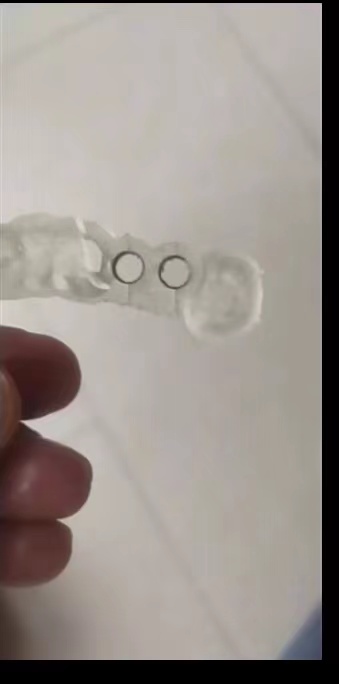 Żywica dentystyczna drukarka 3 – 3D Printing Uv Resin recenzja i cena