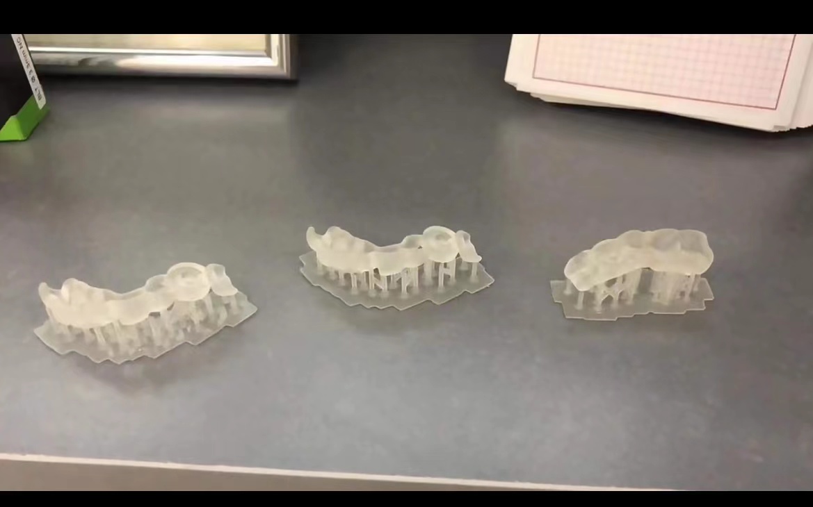 Żywica dentystyczna drukarka 3 – 3D Printing Uv Resin recenzja i cena